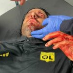 Ο Άρης βύθισε κι άλλο τον ΠΑΣ Γιάννινα Παναγιώτης Κουμάνταρος