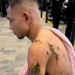 Ανησυχητικά τα στοιχεία για το καλοκαίρι – «Άνυδροι και θερμοί χειμώνες οδηγούν σε μεγάλες πυρκαγιές»