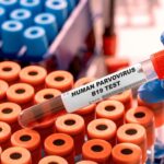 Πρόταση της ΠΑΕ Βόλος για νέο φορμάτ στο πρωτάθλημα Παναγιώτης Κουμάνταρος