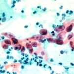 Ιωάννινα: Μέλη ληστρικής συμμορίας 4 ανήλικοι – Συνελήφθησαν και οι μητέρες τους