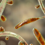 Ξηρασία και διακοπές ρεύματος πίσω από τα κρούσματα σαλμονέλας στη Μαγνησία