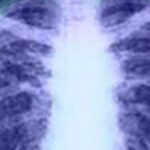 Βάσλε (ΕΚΤ): Δεν είναι απίθανο να γίνουν κι άλλες μειώσεις επιτοκίων το 2024