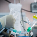 Απαγόρευση κυκλοφορίας σε περιοχές της Θεσσαλονίκης λόγω υψηλού κινδύνου πυρκαγιάς