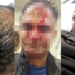 Spetses Mini Marathon 2024: Ρεκόρ συμμετοχών με τις συγκινήσεις και την αγωνιστικότητα στα ύψη!