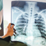 Στολίστηκε το χριστουγεννιάτικο δέντρο στην Πλατεία Συντάγματος – Την Πέμπτη η φωταγώγηση