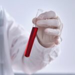 Τροχαίο με μετωπική σύγκρουση ανάμεσα σε βαν και ταξί στην Ευελπίδων