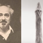 Οι τρεις οπαδοί του ΠΑΟΚ νοσηλεύονται σε σταθερή κατάσταση στη Ρουμανία – Ο ένας έχει πολλαπλά κατάγματα