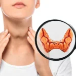 Παθοφυσιολογία: Βιταμίνη Β12… εναντίον κατάθλιψης Newsroom