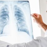 Ερωτήματα για τον θάνατο της 35χρονης στην Άρτα 15 μέρες αφότου γέννησε – Θήλαζε, ένιωσε αδιαθεσία και έχασε τις αισθήσεις της