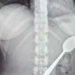 Πυροβολισμοί σε λύκειο στο Μέριλαντ – Τραυματίστηκε μαθητής – Ο ύποπτος είναι υπό κράτηση (live)