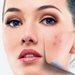 Το διοξείδιο του άνθρακα είναι σε επίπεδα υψηλότερα από ποτέ κι αυτό ίσως μεταβάλλει τη χημεία του αίματός μας Γεωργία Κουρουπάκη