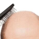 Θεσσαλονίκη: Κυκλοφοριακές ρυθμίσεις στην Πέλλα λόγω διεξαγωγής του 20ού Διεθνούς Μαραθώνιου Δρόμου «Μέγας Αλέξανδρος»