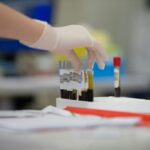 Εξέταση αίματος μπορεί να εντοπίσει σημάδια του Αλτσχάιμερ πολύ πριν από την εμφάνιση των συμπτωμάτων Γεωργία Κουρουπάκη